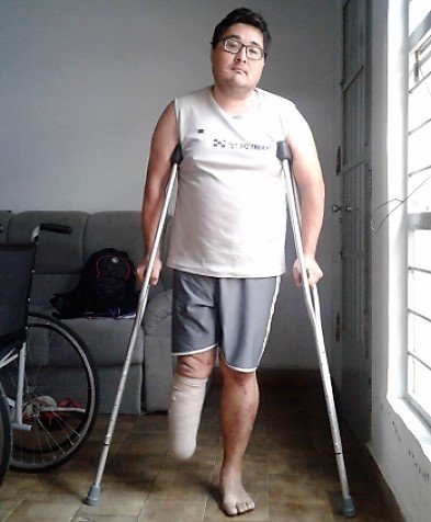 Rapaz pede ajuda para colocar prótese e voltar a trabalhar