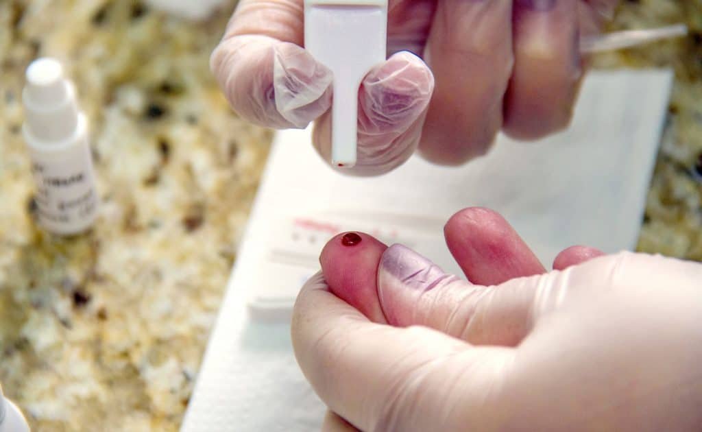 AMI oferece teste rápido e sigiloso de hepatites B e C