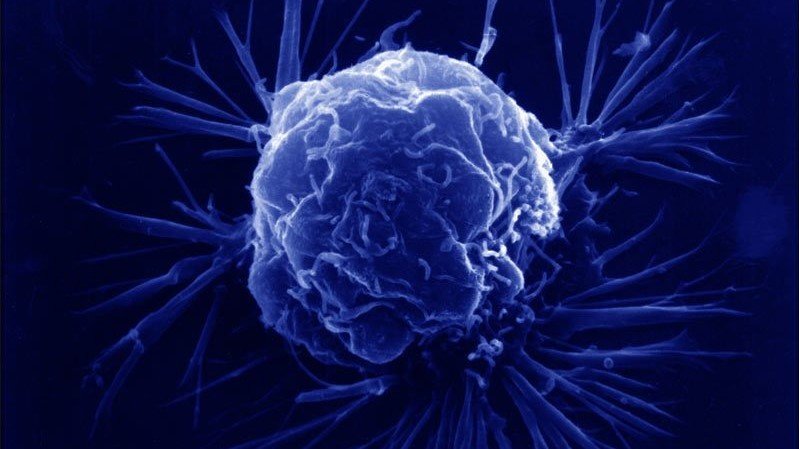 Estudos inéditos trazem novas opções de tratamento para câncer de próstata