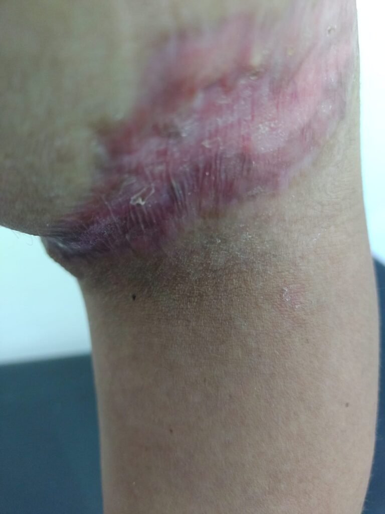 Ministério Público arquiva denúncia de mau atendimento no UPA