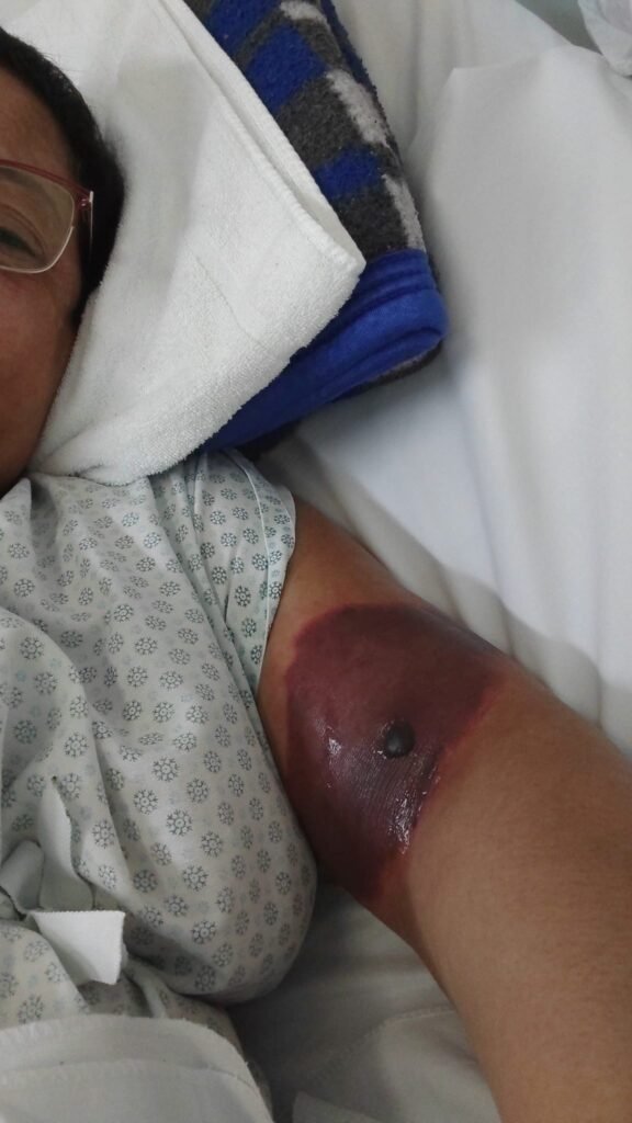 Professora acusa funcionários do UPA de maus tratos e negligência