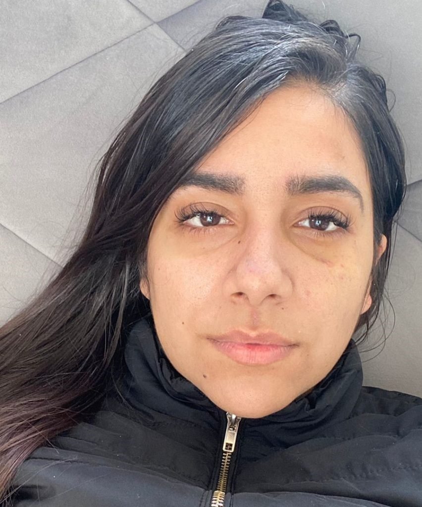 Moça que ficou presa embaixo de carro na Marginal fala em “livramento”