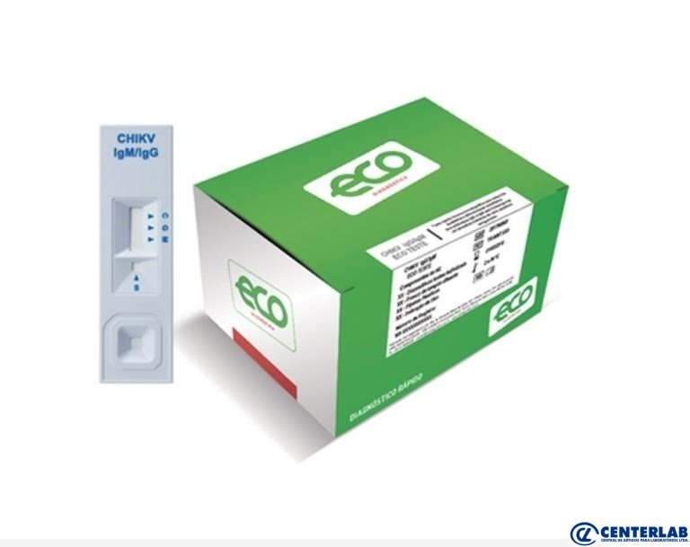 Drogaria São Paulo inicia venda on-line de autotestes de Covid-19