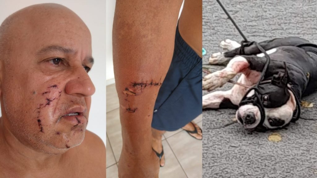 Pit-bull ataca homem no Jardim Mayard