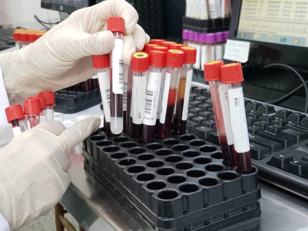 Cidade confirmou, em uma semana, mais 430 casos de Covid-19