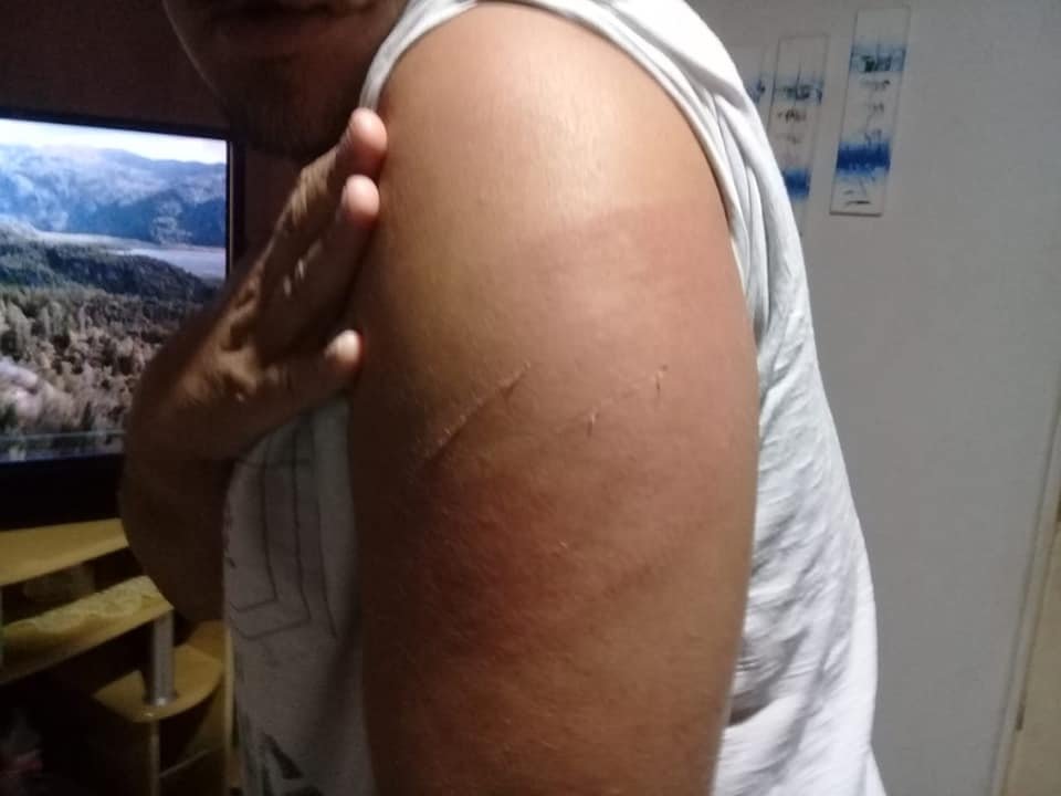 Homem é preso por agredir enteado deficiente