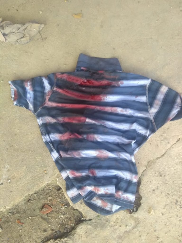 Filho tenta matar pai com golpes de faca